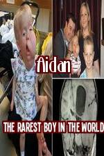 Watch Aidan The Rarest Boy In The World Vodly