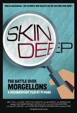 Watch Skin Deep: The Battle Over Morgellons Vodly