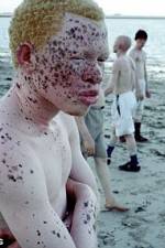 Watch Albino United Vodly