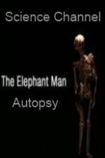Watch Science Channel Elephant Man Autopsy Vodly