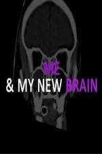 Watch Me & My New Brain Vodly