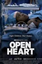 Watch Open Heart Vodly