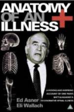 Watch Anatomy of an Illness Vodly