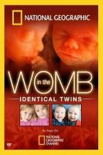 Watch National Geographic: In the Womb - Identical Twins Vodly