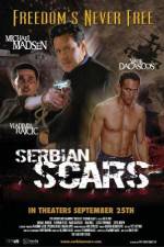 Watch Serbian Scars Vodly