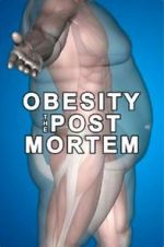 Watch Obesity: The Post Mortem Vodly