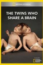 Watch National Geographic The Twins Who Share A Brain Vodly