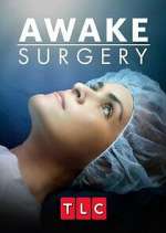 Watch Awake Surgery Vodly
