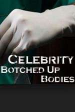 Watch Celebrity Botched Up Bodies Vodly